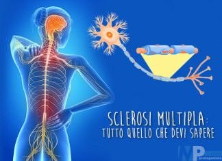 La Sclerosi Multipla e due casi che evidenziano come l’aiuto di uno psicologo è determinante per affrontare la malattia degenerativa.