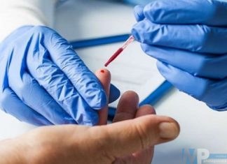 Isernia – Test rapidi Covid -19 per il 15 dicembre, presso l’Auditorium a cura del Gruppo di Protezione Civile e Ambientale.