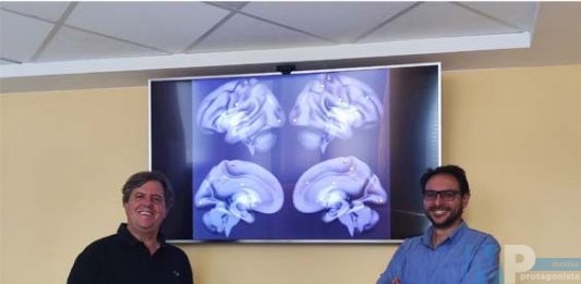 Ricerca Neuromed – L’ipertensione “desincronizza” il cervello