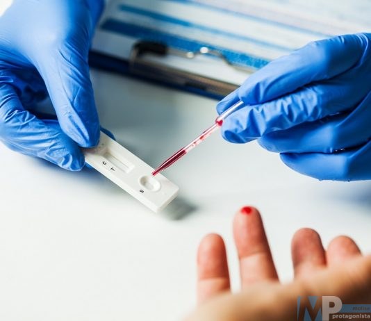 Regione Molise – MovidaCovidfree, obiettivo centrato